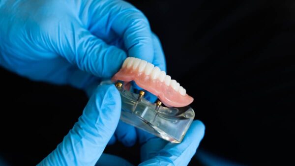 Dentures Bloor west village | Bloor Smile Dental